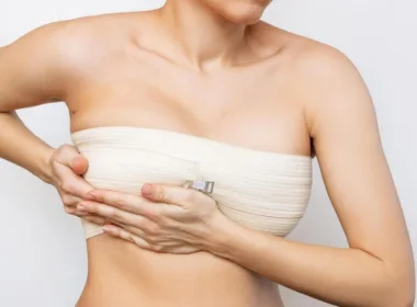 Operacja zmniejszenia piersi - rekonwalescencja i blizny