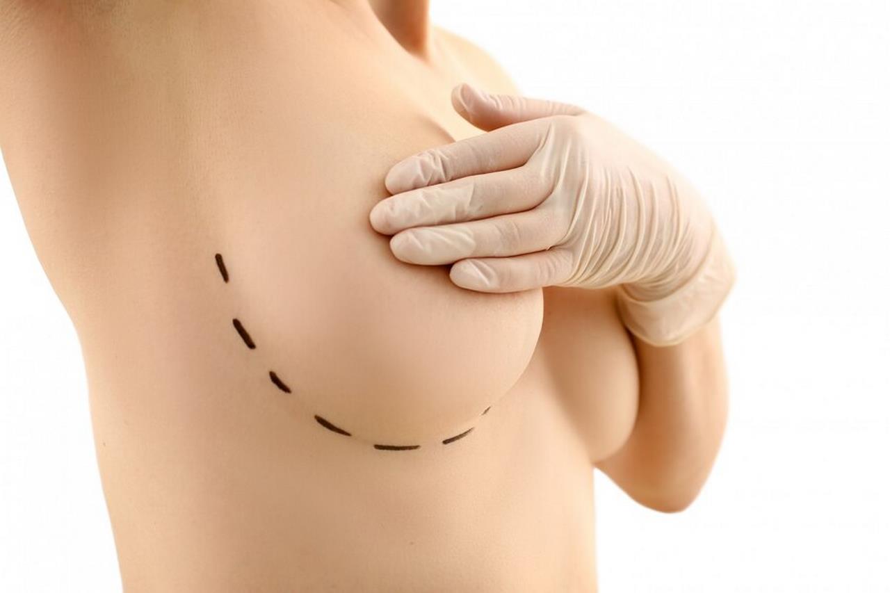 Przyczyny zdrowotne, dla których należy przeprowadzić operację zmniejszenia piersi
